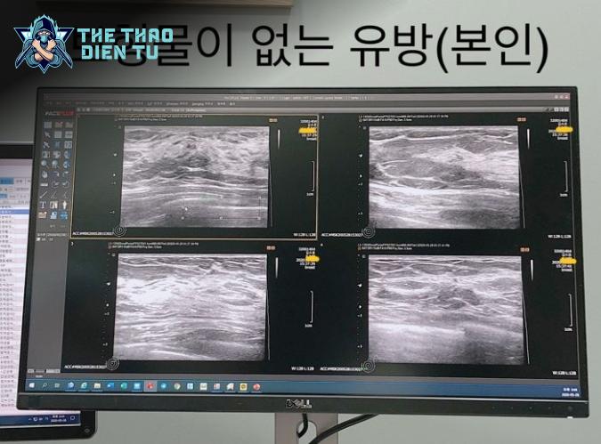 Kết bài: Hành Động Livestream X-Quang Ngực Chứng Minh Vẻ Đẹp Tự Nhiên Của Yeoam - Một Bước Đi Thông Minh Trong Thế Giới Streamer Đầy Cạnh Tranh.